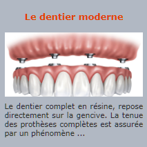 Le dentier moderne